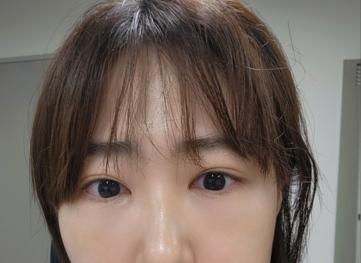 장가은(후).jpg